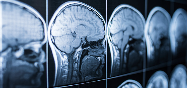 Neurological and cardiac problems